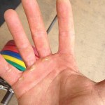 Calluses on Gabe Kapler's hand